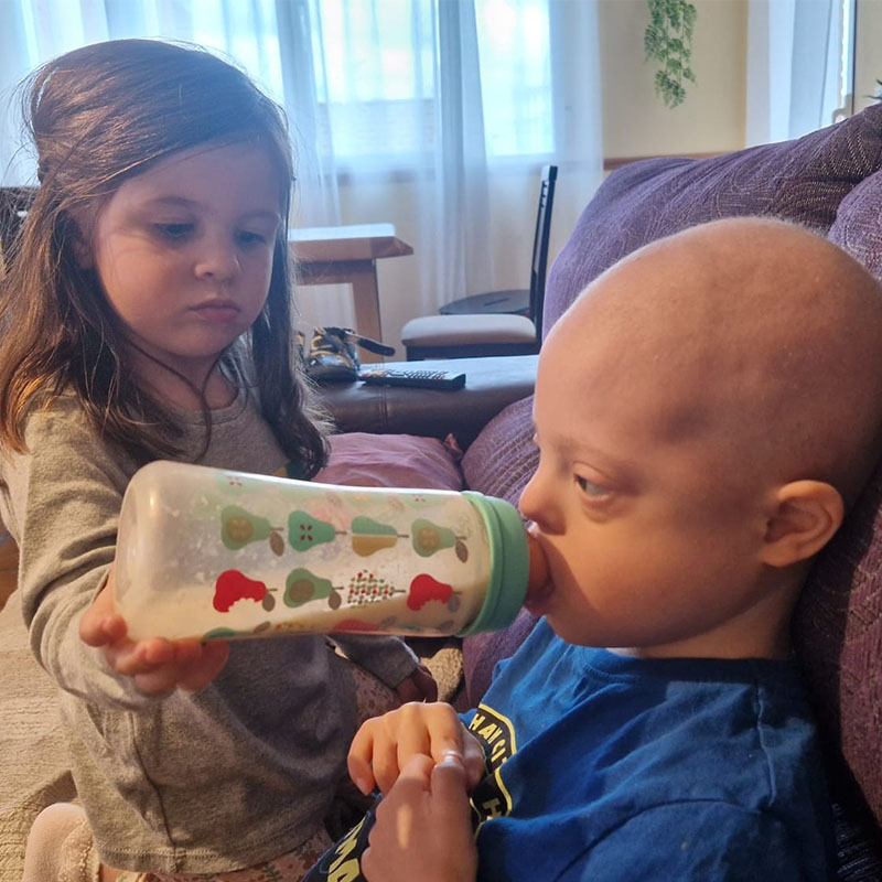 Hugo leucemia sindrome de down